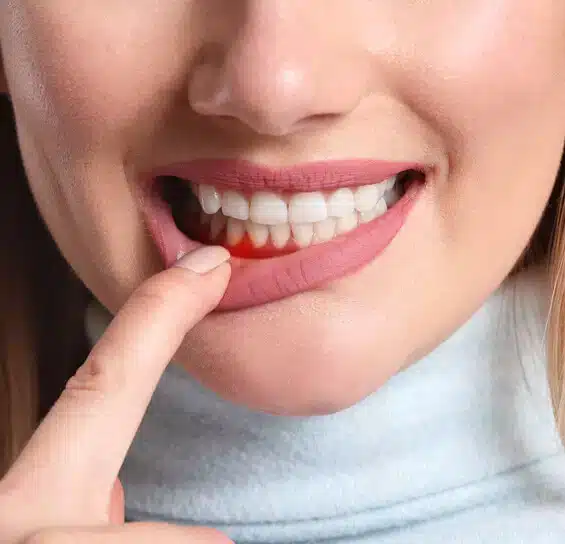 Gum disease treatment in Scottsdale