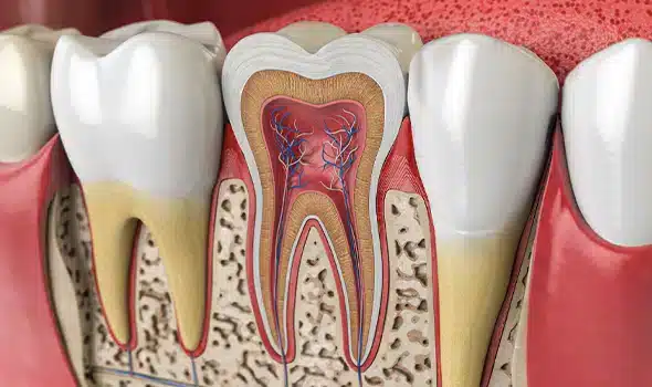 Periodontal surgery and bone grafting